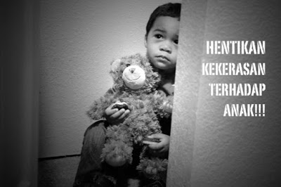 Miris !!! Ibu Kandung Tega  Aniaya Anaknya dengan Cara Disetrika
